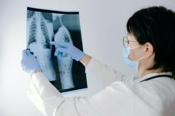 Ofrecerán una charla abierta sobre tuberculosis en el CAPS Pueblo Nuevo