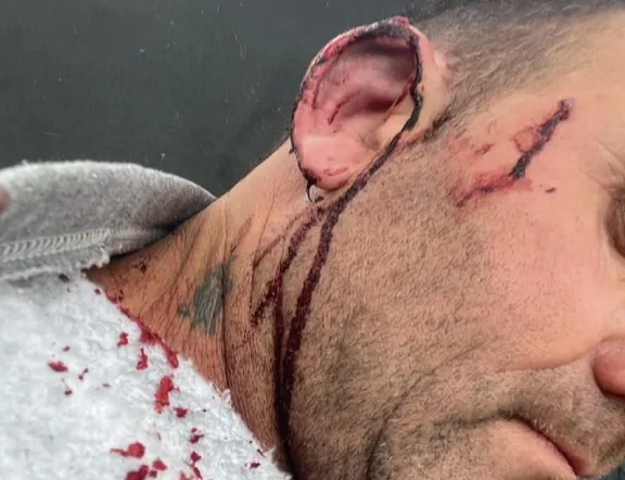 Agredieron al intendente de Pueblo Brugo en el propio palacio municipal